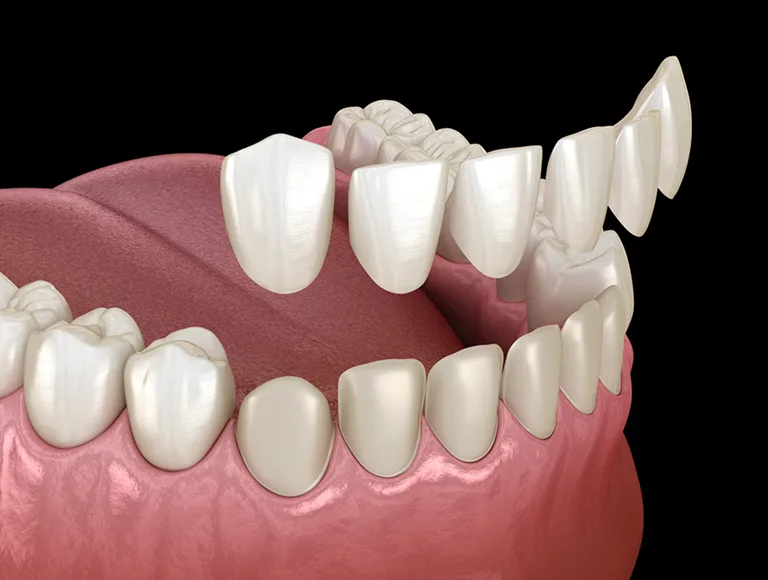 Why the surgeon's credentials matter for a single implant