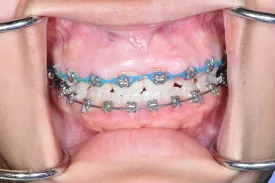 before orthodontics - Las Vegas, NV