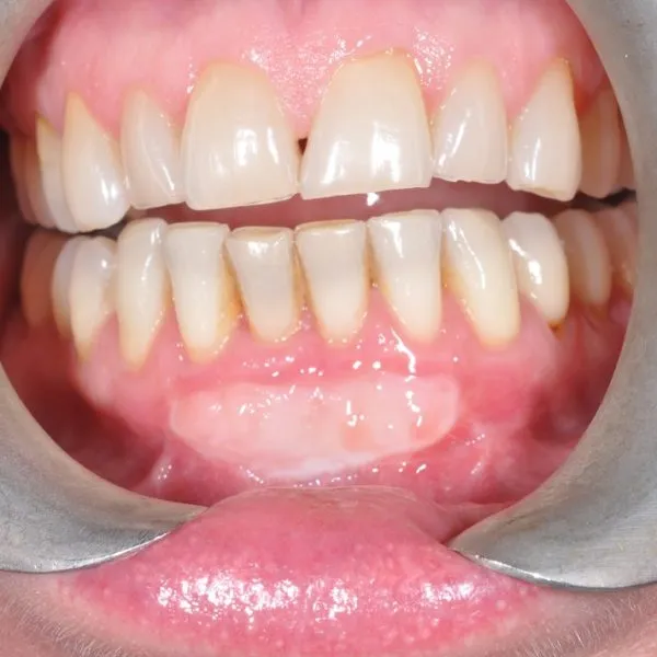 before surgical grafting - Las Vegas, NV