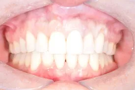 before cosmetic dentistry - Las Vegas, NV