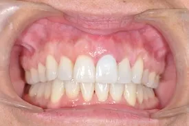 after cosmetic dentistry - Las Vegas, NV